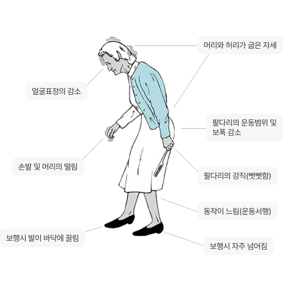 임상증상